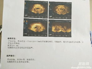 香港验血结果16项n(香港验血查dna结果单子怎么看 ) 