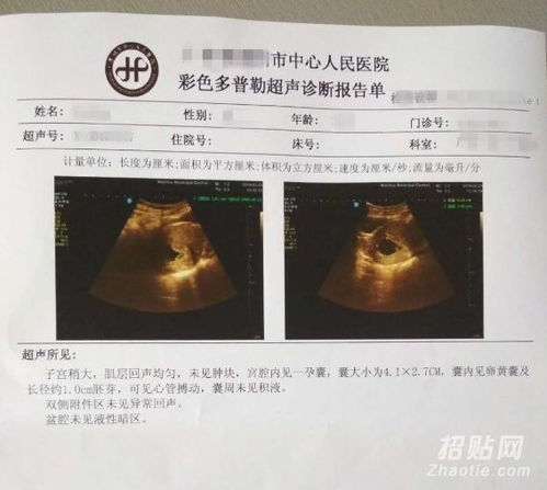 网上香港验血查男女准不准(去香港验血DNA性别准不准) 