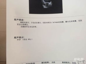 香港验血具体价格查询(有宝妈去过香港仁健医学验血的嘛 有