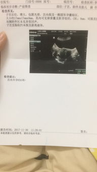 孕囊数据女香港验血男(怀孕7周hcg6万多是男是女) 