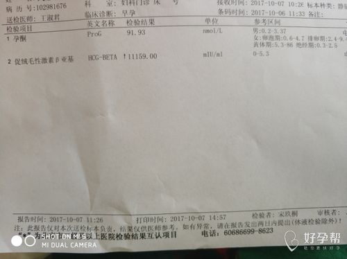 孕17周香港验血单子(孕期一般都通过什么症状来判断男女呢 )