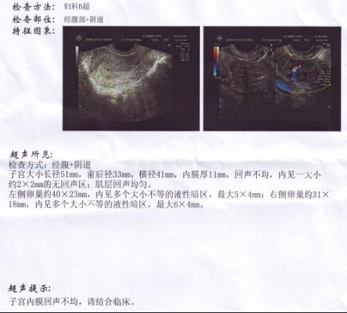 b超和香港验血哪一个准确点(香港康盈基因检测中心验血是男