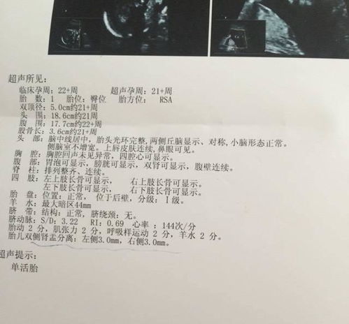 香港验血需要b超单7周(香港验血要怀孕多少周才可以去) 